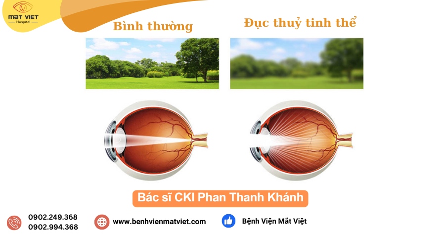 Câu 1: Đối tượng nào thường có nguy cơ mắc bệnh này? Nhiều người nghĩ rằng bệnh này chỉ có ở người già vì tuổi tác, quan điểm này có đúng không ?