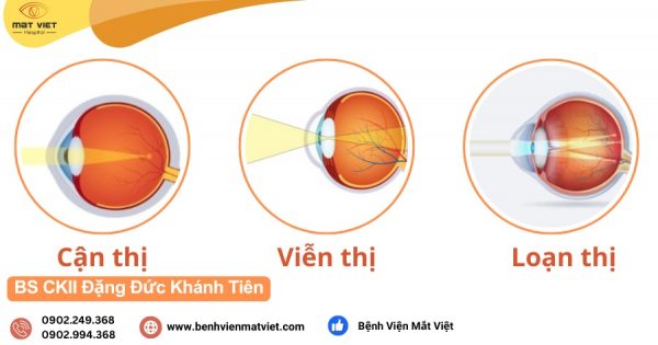 Tật khúc xạ là gì?